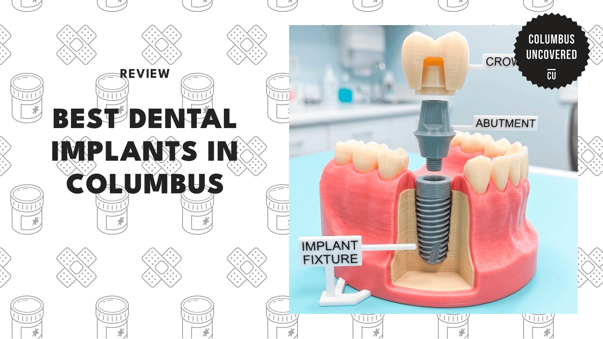 dental-implant-clinics-columbus