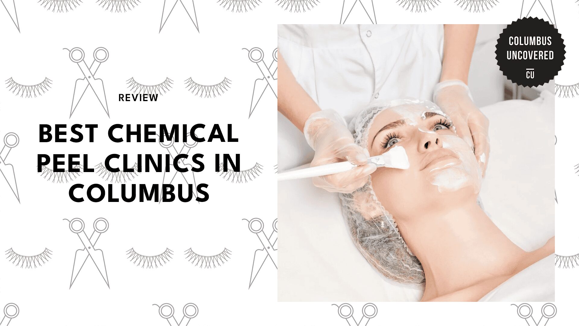 best-chemical-peel-columbus
