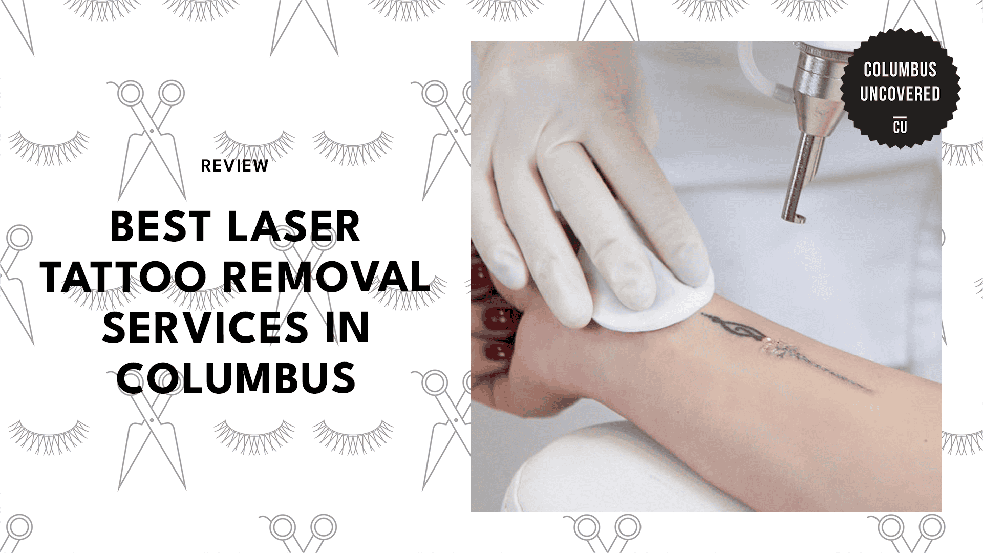 laser-tattoo-removal-clinics-in-columbus