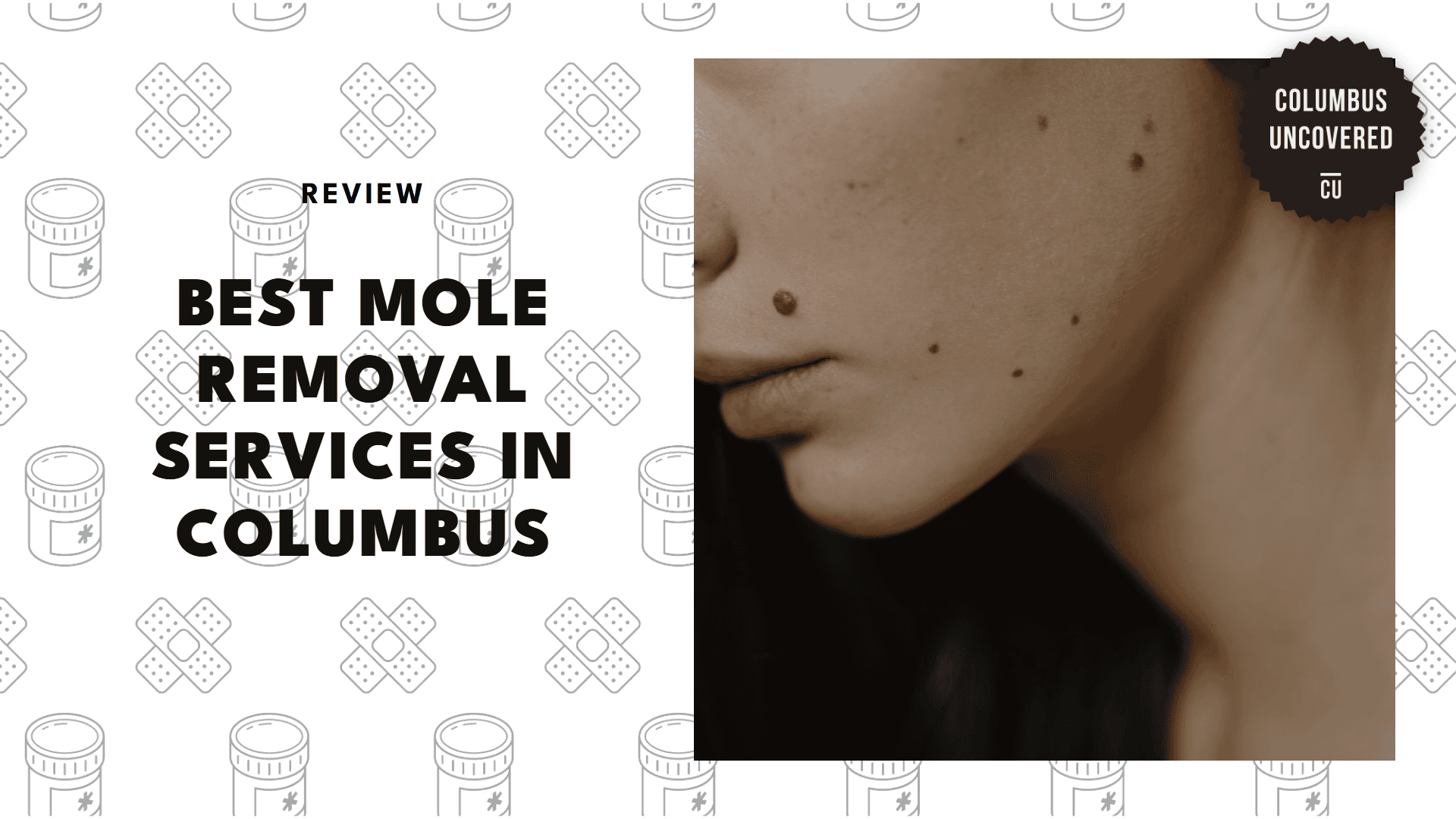 best-mole-removal-columbus